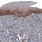 Immunohistochemical staining of human uterine cervix shows strong membranous positivity in squamous epithelial cells.