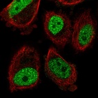 Anti-ABHD8 Antibody