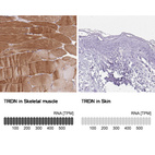 Anti-TRDN Antibody