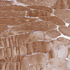 Immunohistochemical staining of human skeletal muscle shows strong cytoplasmic positivity in myocytes.