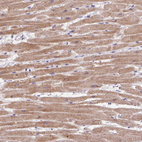 Immunohistochemical staining of human heart muscle shows moderate cytoplasmic positivity in cardiomyocytes.