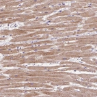 Immunohistochemical staining of human heart muscle shows moderate cytoplasmic positivity in cardiomyocytes.