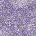 Immunohistochemical staining of human lymph node shows no positivity in non-germinal center cells as expected.