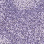 Anti-TRDN Antibody