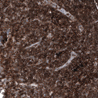 Anti-CD44 Antibody