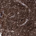 Immunohistochemical staining of human lymph node shows strong membranous positivity in lymphoid cells.