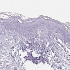 Immunohistochemical staining of human skin shows no positivity in squamous epithelial cells as expected.