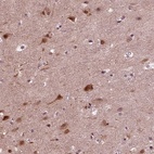 Anti-NAP1L5 Antibody