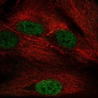 Immunofluorescent staining of human cell line BJ shows localization to nucleoplasm.