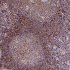 Anti-SLC9A9 Antibody