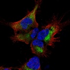 Anti-SESTD1 Antibody