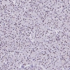 Immunohistochemical staining of human pancreas shows strong positivity in nucleoli in exocrine glandular cells.