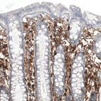 Anti-CD44 Antibody