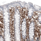 Immunohistochemical staining of human colon shows strong membranous positivity in lymphoid cells.
