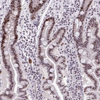 Immunohistochemical staining of human small intestine shows strong positivity in nucleoli in glandular cells.
