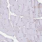 Immunohistochemical staining of human skeletal muscle shows moderate positivity in nucleoli in myocytes.