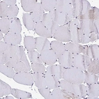 Immunohistochemical staining of human skeletal muscle shows moderate positivity in nucleoli in myocytes.