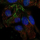 Anti-TRMT10A Antibody