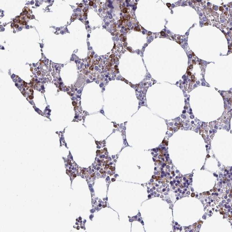 Anti-TXNRD3NB Antibody