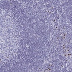 Anti-SLC25A51 Antibody