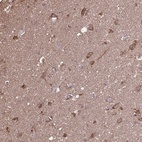 Anti-ACOT6 Antibody