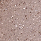 Anti-ACOT6 Antibody