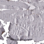 Immunohistochemical staining of human skeletal muscle shows no positivity in myocytes as expected.