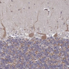 Immunohistochemical staining of human cerebellum shows moderate cytoplasmic positivity in Purkinje cells.