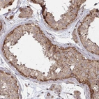 Immunohistochemical staining of human testis shows moderate cytoplasmic positivity in cells in seminiferous ducts.