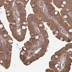 Immunohistochemical staining of human small intestine shows moderate positivity in glandular cells.
