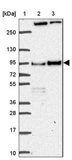 Lane 1: Marker [kDa] 250, 130, 95, 72, 55, 36, 28, 17, 10_br/_Lane 2: Human cell line RT-4_br/_Lane 3: Human cell line U-251 MG