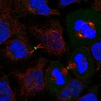 Anti-DVL3 Antibody