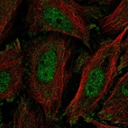 Anti-KLF11 Antibody