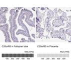 Anti-C20orf85 Antibody