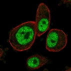 Immunofluorescent staining of human cell line PC-3 shows localization to nucleoplasm.