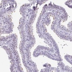 Immunohistochemical staining of human fallopian tube shows high expression.