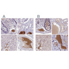 Anti-HGFAC Antibody