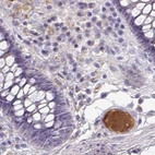 Immunohistochemical staining of human colon using Anti-HGFAC antibody HPA058279.