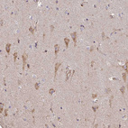 Anti-B4GALT6 Antibody