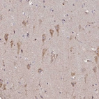 Anti-B4GALT6 Antibody