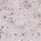 Anti-ZNF699 Antibody