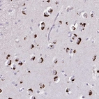Anti-GLTPD2 Antibody
