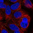 Immunofluorescent staining of human cell line CACO-2 shows localization to vesicles.