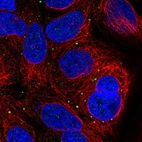 Immunofluorescent staining of human cell line CACO-2 shows localization to vesicles.