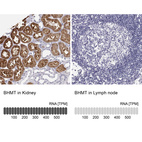 Anti-BHMT Antibody