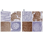 Immunohistochemical staining of human colon, kidney, liver and lymph node using Anti-BHMT antibody HPA058310 (A) shows similar protein distribution across tissues to independent antibody HPA038285 (B).