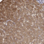 Immunohistochemical staining of human liver shows moderate cytoplasmic positivity in hepatocytes.