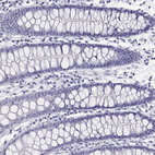 Anti-BHMT Antibody