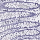 Immunohistochemical staining of human colon shows no positivity in glandular cells as expected.