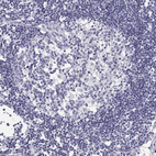 Anti-BHMT Antibody